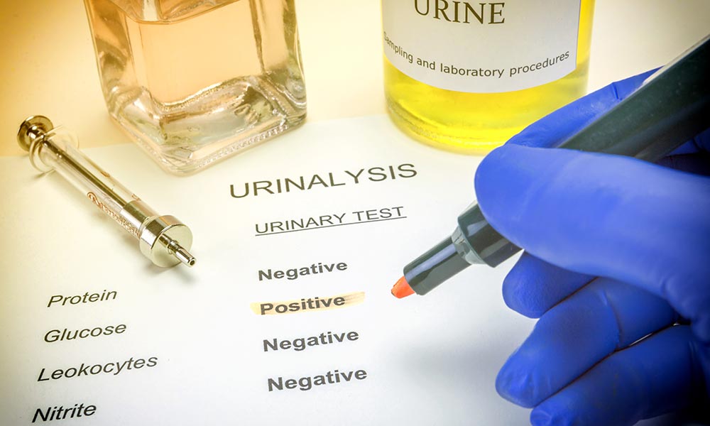 Type of test and sample play the most significant role. Urine, saliva, blood, hair and sweat tests